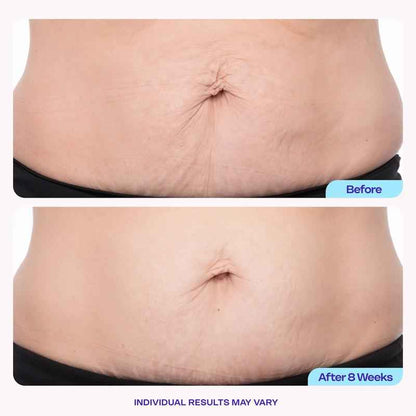 GOPURE Tighten & Smooth Belly Firming Cream