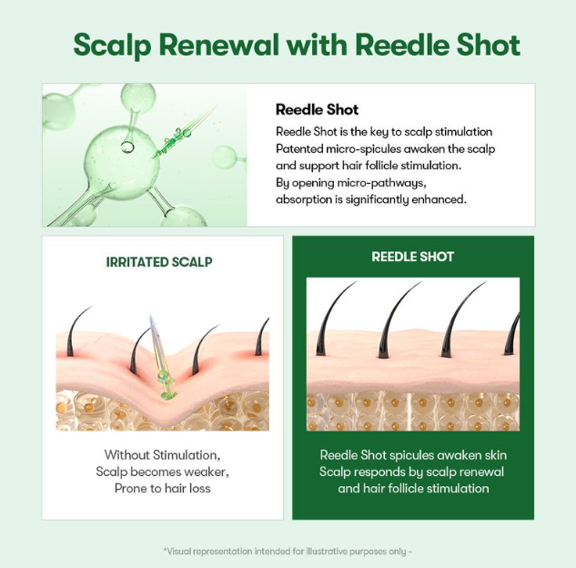 An informational graphic titled 'Scalp Renewal with Reedle Shot' explaining scalp stimulation. It includes a green molecular illustration, a cross-section of an irritated scalp with a needle, and a panel showing hair follicles stimulated by Reedle Shot spicules.