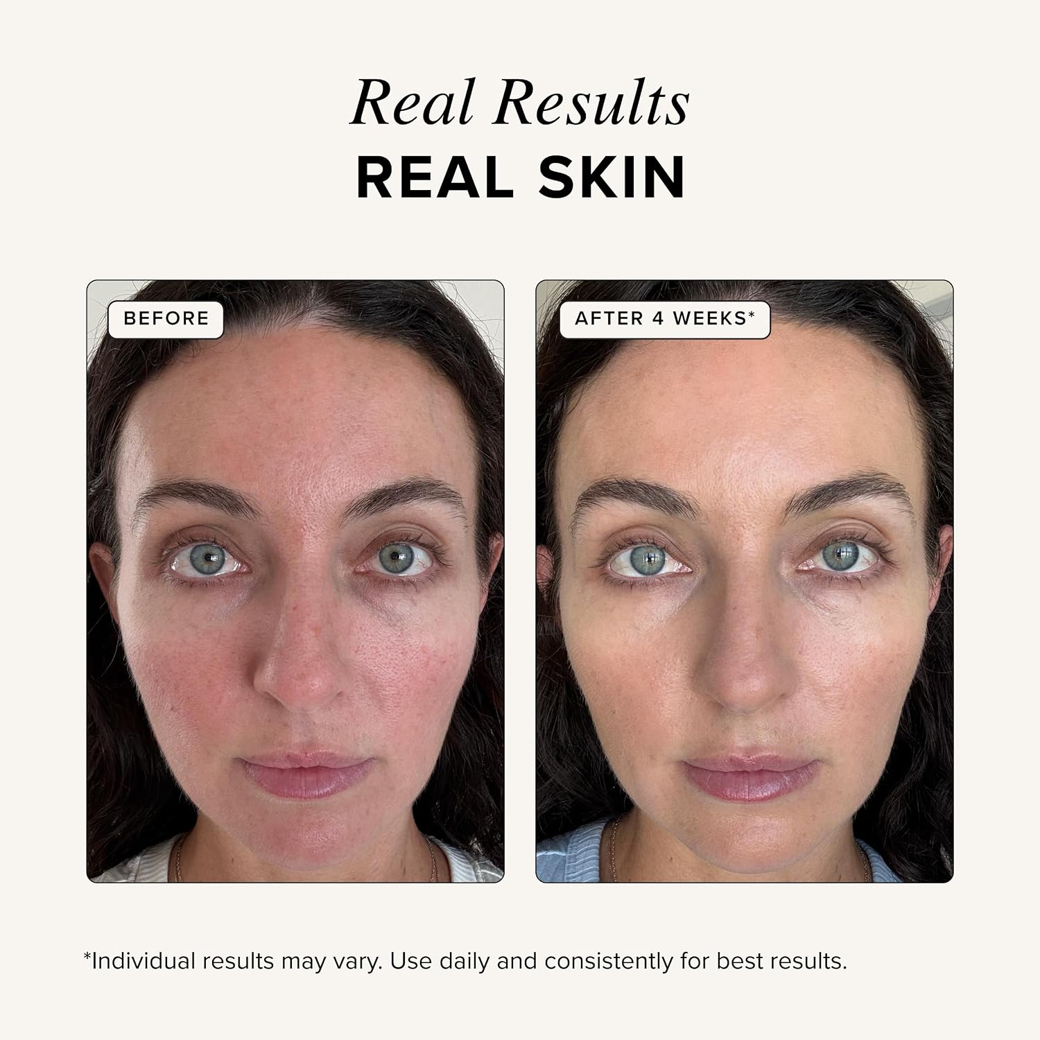Copper Peptide Face Serum four-week before-and-after skin appearance comparison