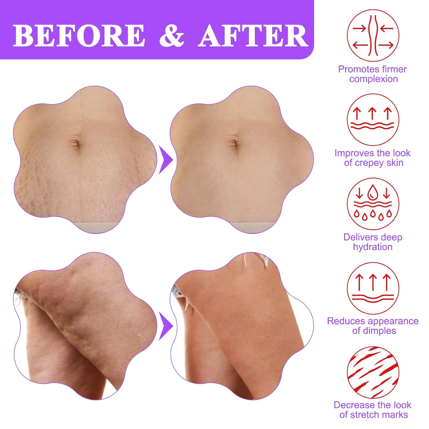 goPure Belly Firming Cream before-and-after body skin appearance and hydration benefits graphic